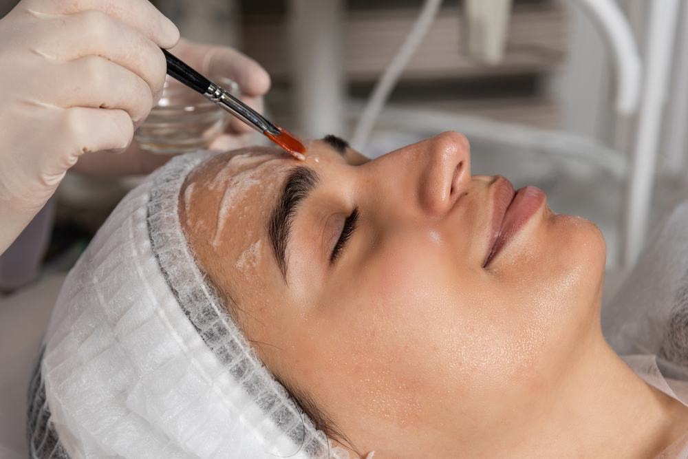 Are Chemical Peels Safe for Your Skin